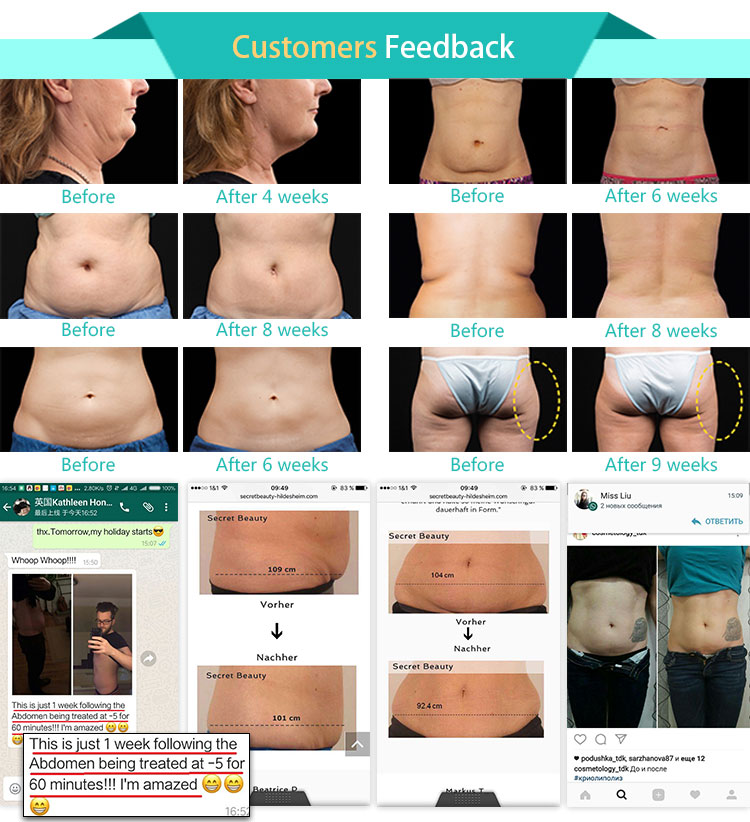 Fda approved 2 cryo handles cool shape machine cool tech fat freezing slimming machine