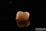 Dental Restoration Material Multilayer Full Zirconia 1200 HV Hardness Crack