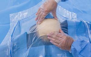 Wholesale Medical Sterile Craniotomy Drape Surgical With Aperture 1pc / Pouch from china suppliers