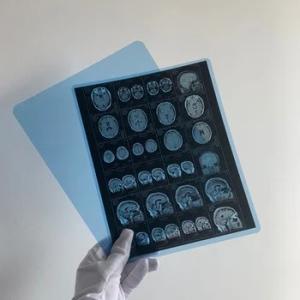 Wholesale Medical X Ray Dry Film Medical X Ray Inkjet Film With Clear Image Quality from china suppliers