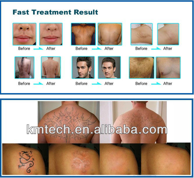 5in1 Salon / Spa IPL RF Cavitation Machine YAG Laser Skin Care Beauty Equipment