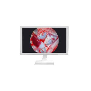 Wholesale FHD Medical Equipment 22 24 27 Inch Endoscope Camera Monitor Display Full HD Medical Monitor from china suppliers