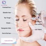 Anti Wrinkle 2ml Injectable Dermal Fillers Restore Youthful Skin For Lips