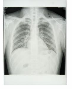 Wholesale Custom 25cm * 30cm White Base Xray Paper Medical Film with PET materials from china suppliers