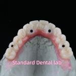 Porcelain Zirconia Dental Implant Bridge Professional High Esthetics With Pink