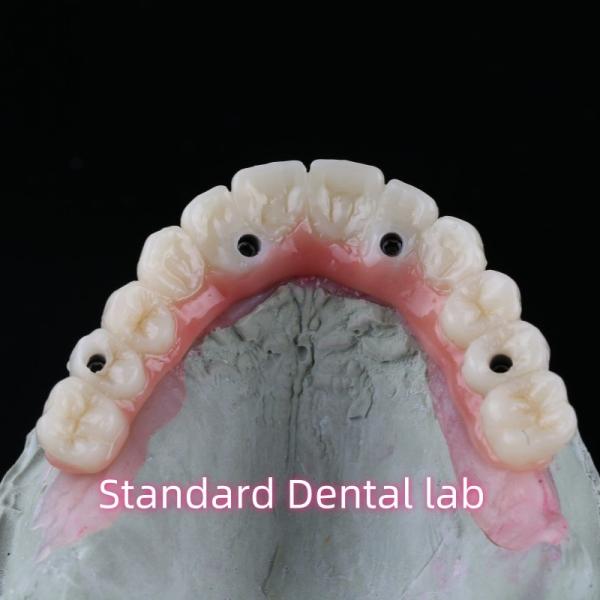 Porcelain Zirconia Dental Implant Bridge Professional High Esthetics With Pink