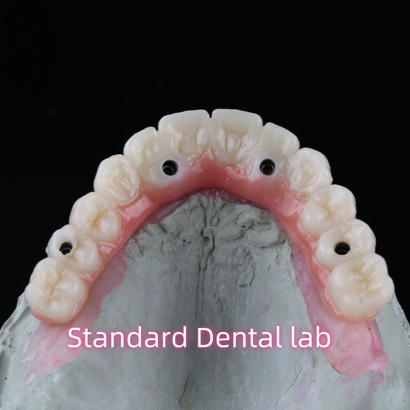 Porcelain Zirconia Dental Implant Bridge Professional High Esthetics With Pink Gum