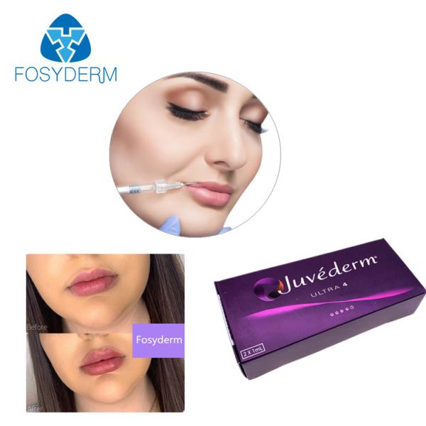 Ultra3 Ultra4 Voluma Hyaluronic Acid Dermal Filler Gel Juvederm Lip Filler 24mg