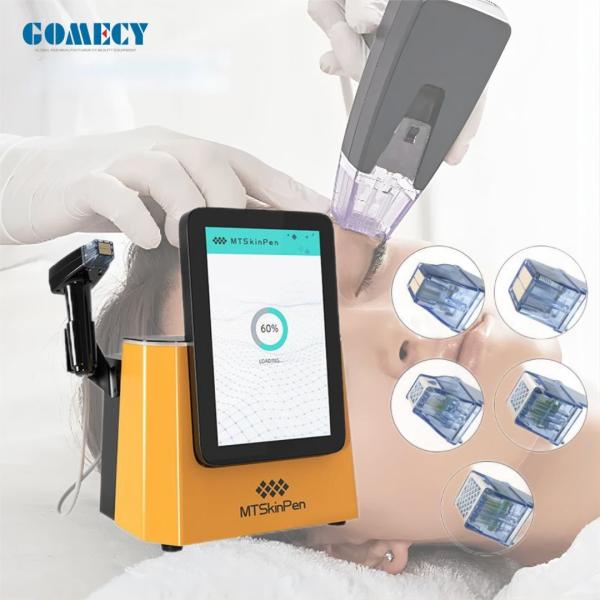 Treatment For Fine Lines Acne Treatment Nasolabial Folds Cervical Stripes