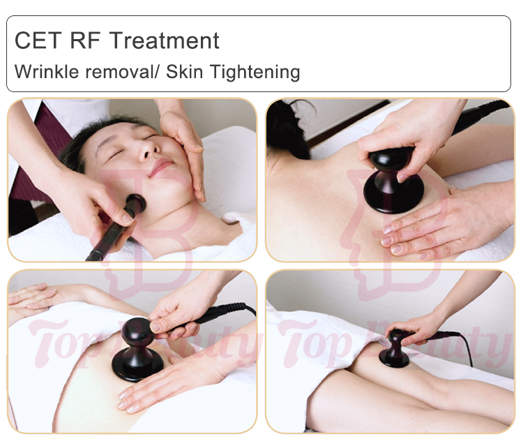 80Ma RMS RF 0.5Mhz Pain Relief Tecar Therapy Machine For Home