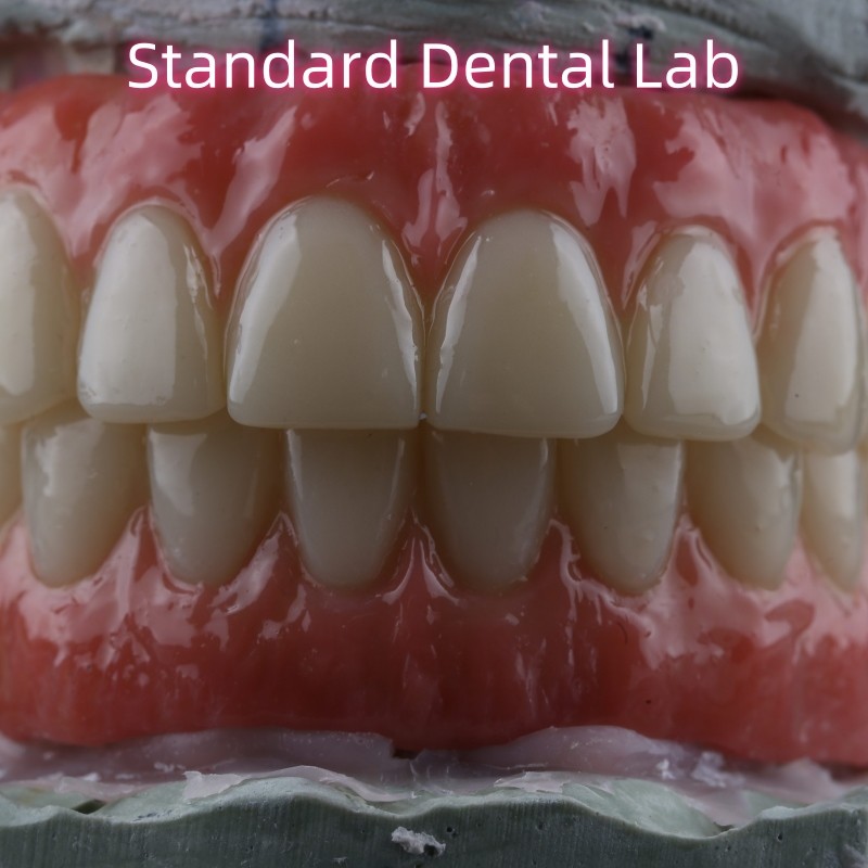 Dental Implant Crown PFZ Porcelain Layered Zirconia Screw Retained With Pink Gum