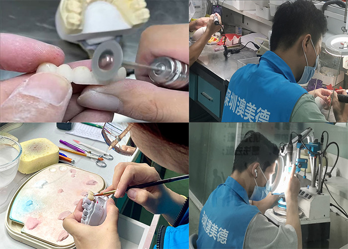 Translucent Natural Looking Zirconia dental Crown with Excellent Durability and Precise Fit
