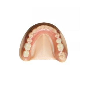 Wholesale OEM Zirconia Dental Crown Removable Denture Professional Dental Laboratory from china suppliers