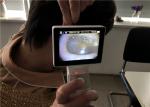 Lcd Monitor Digital Video Otoscope Ophthalmoscope For Clinical Inspection Of