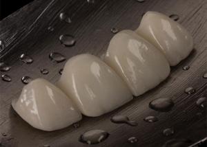 Wholesale Customizable Ceramic Crown Bridge For Missing Tooth Comfortable Perfect Fit from china suppliers