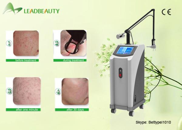 2016 Best Laser Skin Resurfacing vaginal tightening Fractional CO2 Laser 10600nm