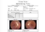 Ophthalmoscope Portable Handheld Fundus Camera Telemedicine Available Video