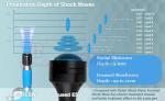 Professional Eswt Shock Wave Machine Eswt Shockwave Therapy Machine Erectile