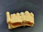 OEM 3D Printing Flexible Acrylic Denture Dental lab Digital Design