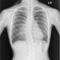 Wholesale 10 X 12 Inch X Ray Medical Imaging from china suppliers