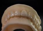 Translucency Stain Resistant Ceramic Crown Bridge Precise Fit for Natural