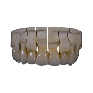 Wholesale Full Mouth Zirconia Dental Crown Restoration Zirconia Fixed Bridge Chemical Resistance from china suppliers