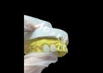 Natural Zirconia Dental Crowns With High Strength And Biocompatibility