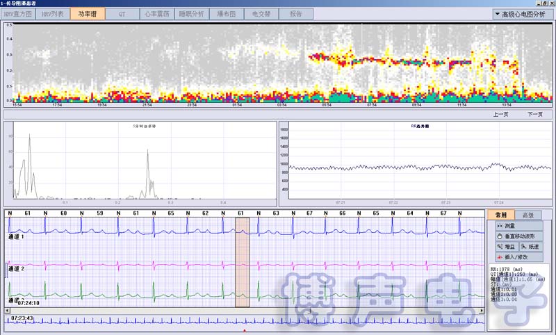 12 Channels Holter ECG Recorder 24 Hours Ambulatory Digital Holter Monitor for CARDIOSCAN Analysis Software