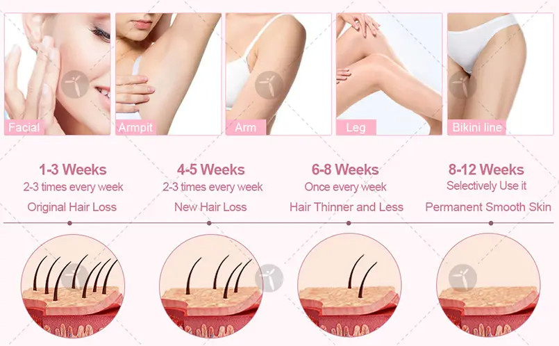 Vertical Ipl Wavelength 640nm Opt Hair Removal Machine