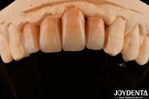 Wholesale Polished Layered Zirconia White And Durable For Perfect Surface Finish from china suppliers