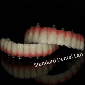 Wholesale Implant Screw Cement Retained Dental Restorations from Standard Dental Lab from china suppliers