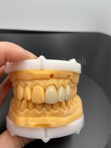 Wholesale Precision Fit Digital Crowns Implant Dentrues With Compatibility Email Transmission Mode from china suppliers