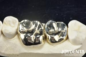 Wholesale Wax Casting Dental Repair Full Metal Crown For Abrasion Resistant Oral Rehabilitation from china suppliers