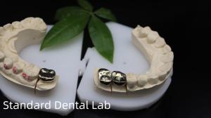 Wholesale Professional ISO and FDA Approved Yellow Gold Crown for Dental Lab Shipping UPS Or Fedex Production Time 2 Days from china suppliers