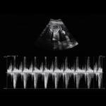 Fetal Doppler Medical Ultrasound Machine Trolley 3D 4D 5D