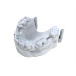 Precision Dental Model Resin Ultra Tough Dental Resin 3d Printing