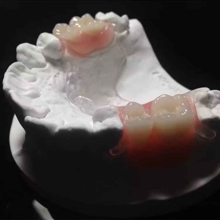 Flexible Clear Metal Cast Framework Partial Dentures High Esthetics Perfect Fit