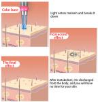 Medical Q Switched Nd Yag Laser Machine , Beauty Laser Tattoo Removal Machine