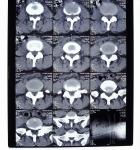 10in * 12in 11in * 14in High Density Medical Imaging Dry Films For AGFA / Fuji