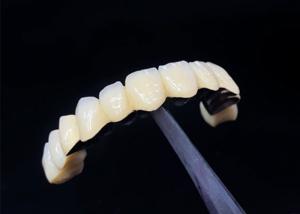 Wholesale Porcelain Fused To Metal Crown Combining Durability And Beauty For Dental Health from china suppliers
