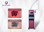 Picosecond Laser Tattoo Removal ND YAG Laser Equipment High Energy