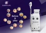 Intelligent IPL Machine For Skin Rejuvenation , Skin Rejuvenation Beauty