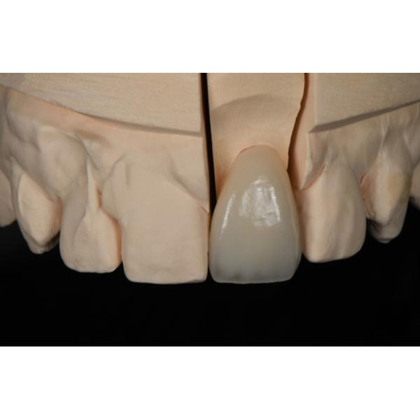1200HV Anterior Implant Multilayer Zirconia Disc UT For Dental Lab Wecera
