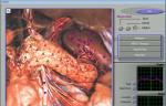 Quantum Resonance 3d Nls Health Analyzer For Full Body Diagnostic