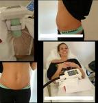 Salon Cryo Fat Freezing Machine , Cryo Lipo Fat Freeze Equipment For Fast Fat