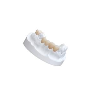 Wholesale IPS E Max Ceramic Dental Crown Comfortable Porcelain Composite Veneers from china suppliers