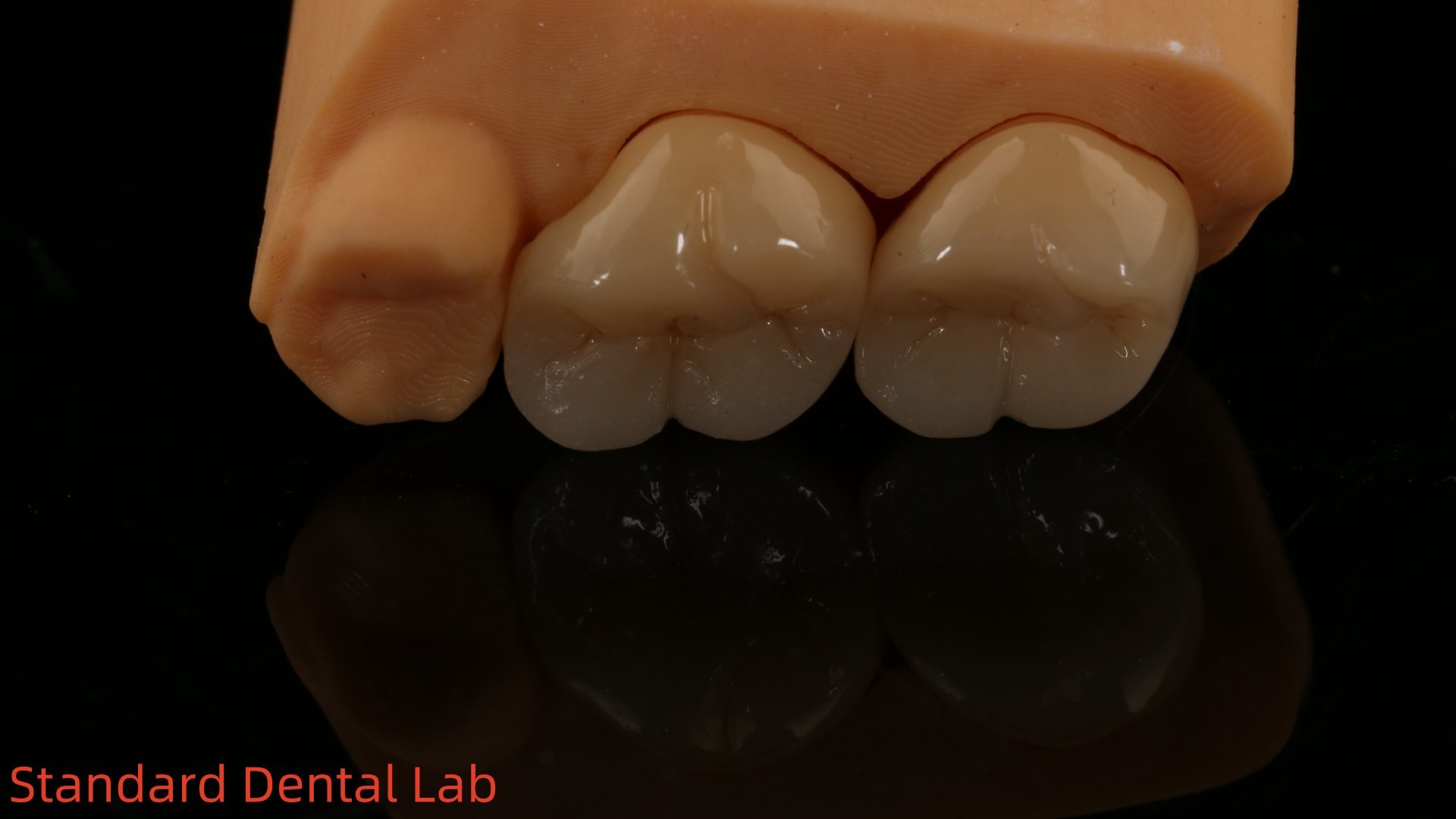 Solid Dental Lab Crowns 3D Pro High Translucency Full Zirconia Crowns with 5-Year Guarantee