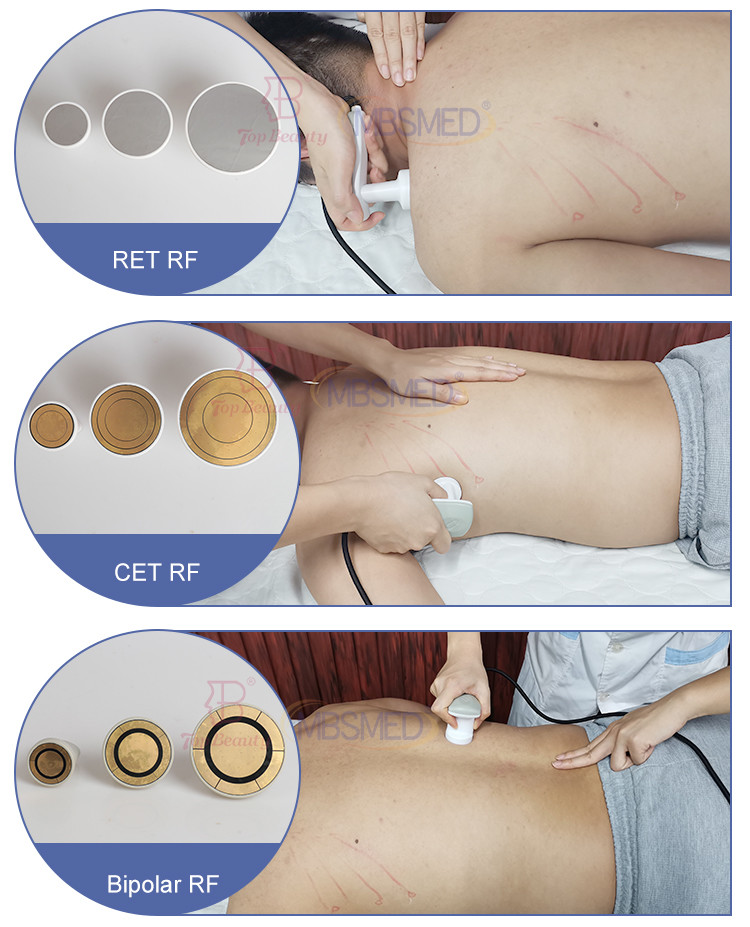 Tecarterapia Indiba Tecar Pain Therapy Diatermia Health Machine