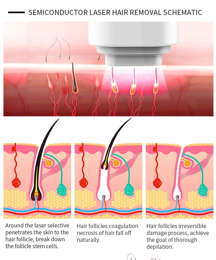 Diode Laser Beauty Equipment 755 808 1064 Hair Removal Skin Rejuvenation