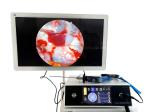 TUYOU Manufacturers Full HD Camera Medical Rigid Borescope For Ent Hospital And